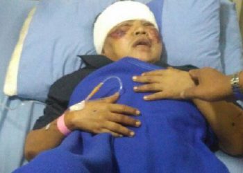 Sadis, Boru Sirait Ini Dibacok dan Diseret  Suami di Aspal. Pelaku Bermarga Samosir Masih Buron…