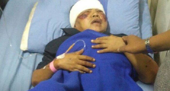 Sadis, Boru Sirait Ini Dibacok dan Diseret Suami di Aspal. Pelaku Bermarga Samosir Masih Buron… Sadis, Boru Sirait Ini Dibacok dan Diseret Suami di Aspal. Pelaku Bermarga Samosir Masih Buron…