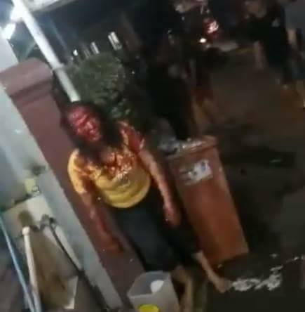 Sadis, Boru Sirait Ini Dibacok dan Diseret Suami di Aspal. Pelaku Bermarga Samosir Masih Buron… Sadis, Boru Sirait Ini Dibacok dan Diseret Suami di Aspal. Pelaku Bermarga Samosir Masih Buron…