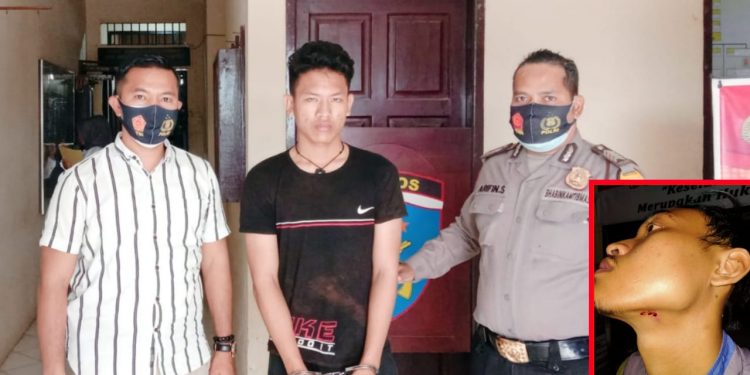 Frengki Marbun Tusuk Dagu Arik Tua Pakai Kunci Sepedamotor