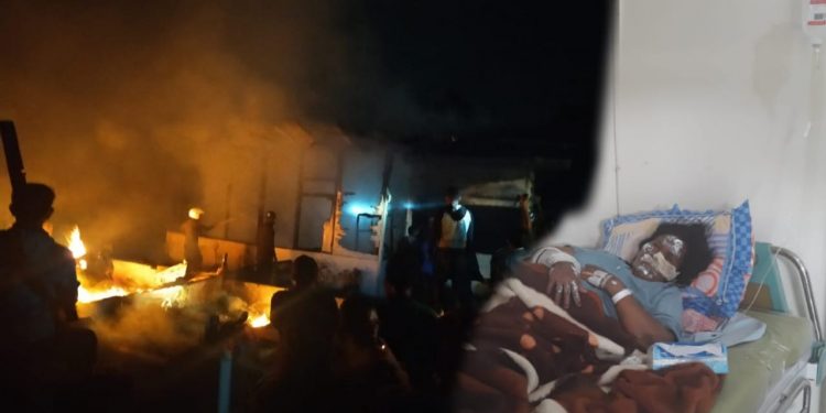 Diana Boru Simorangkir Terbakar, Selamatkan Cucu saat Kebakaran Rumah
