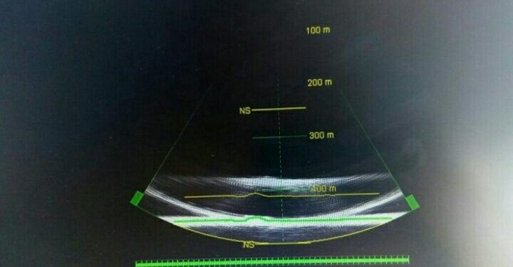 Alat Sonar Temukan Bangkai Kapal Sinar Bangun? Alat Sonar Temukan Bangkai Kapal Sinar Bangun?