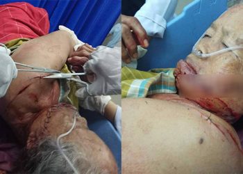Tak Diberi Uang Rokok, Anak Durhaka Bacok Ibunya di Langkat