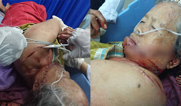 Tak Diberi Uang Rokok, Anak Durhaka Bacok Ibunya di Langkat Tak Diberi Uang Rokok, Anak Durhaka Bacok Ibunya di Langkat