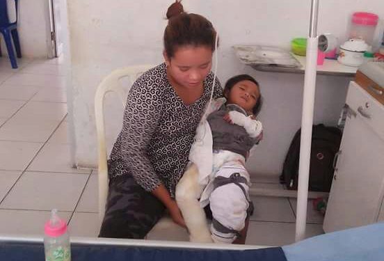 Bocah Tersiram Kuah Miso Itu Akhirnya Meninggal...