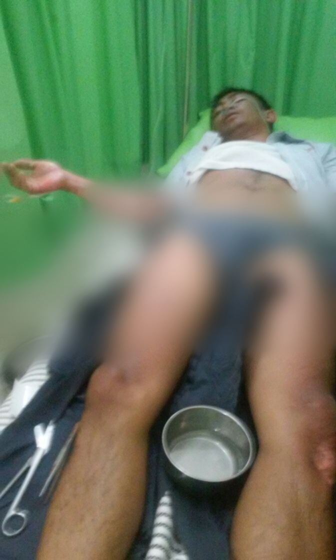 Tabung Gas Meledak, Karyawan KFC Terbakar...