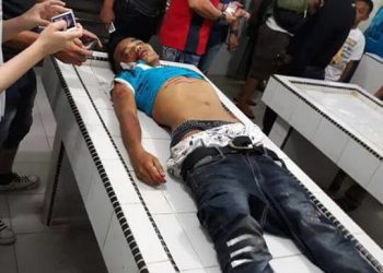 Polisi Tembak Dua Pelaku Begal yang menewaskan Rara Stefanie, Pegawai BNI. Soerang pelaku tewas, satu lainnya ditembak di kaki
