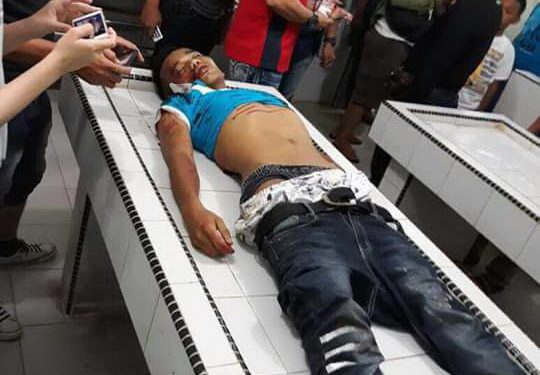 Polisi Tembak Dua Pelaku Begal yang menewaskan Rara Stefanie, Pegawai BNI. Soerang pelaku tewas, satu lainnya ditembak di kaki