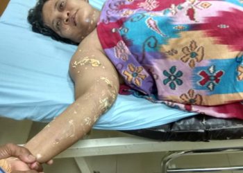 Tragis! Wanita Penjaga Parkir Disiram Cairan Kimia oleh Seorang Pria. Ini Penyebabnya...