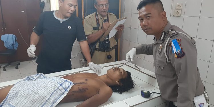 Mr X Ditemukan Tergeletak dan Luka-luka di Jalan Siantar-Perdagangan Mr X Ditemukan Tergeletak dan Luka-luka di Jalan Siantar-Perdagangan
