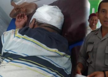 Bripka Joel Gultom Dapat 7 Jahitan Di Kepala, Ini Penjelasan Kapolsek Raya