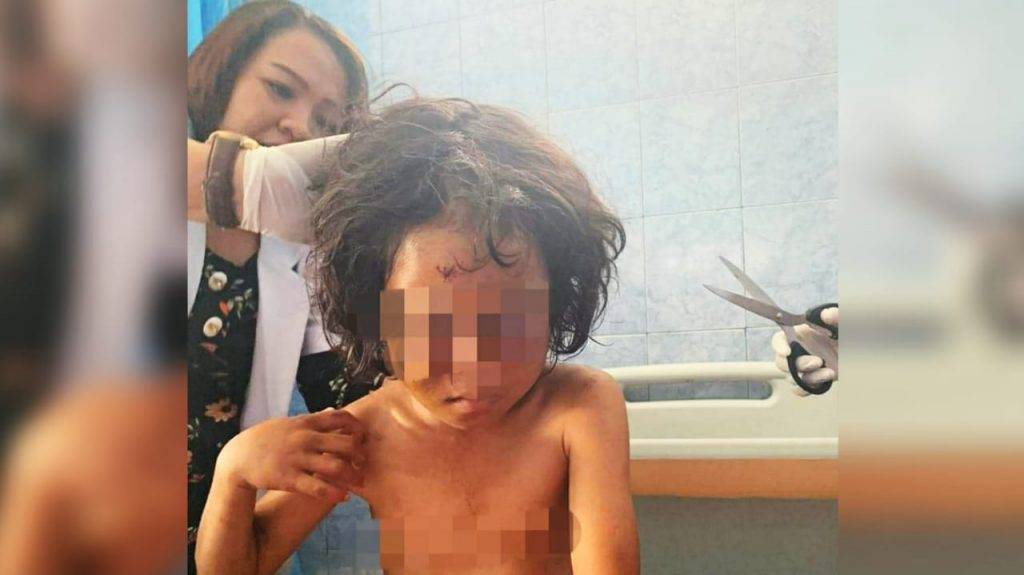 Parida Siahaan, Ibu yang Aniaya Putri Kandungnya di Simalungun Resmi Tersangka