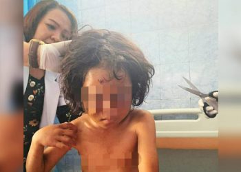 Ketahuan Curi Uang, Bocah Perempuan di Simalungun Dianiaya Ibu Kandungnya