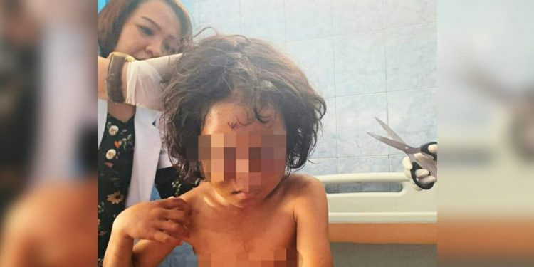 Ketahuan Curi Uang, Bocah Perempuan di Simalungun Dianiaya Ibu Kandungnya