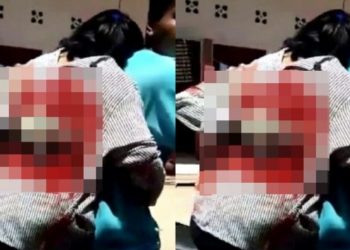 Viral, Cewek SMA Ditikam 4 Kali Karena Ogah Diajak 'Begituan'
