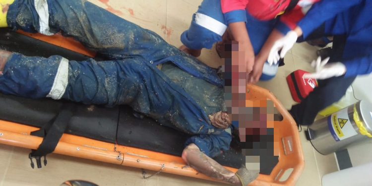 Sumur Bor PLTP Sarulla Meledak, 1 Pekerja Tewas, 2 Luka-luka