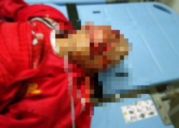 Diduga Mabuk Saat Berkendara, Amran Malau Tabrak Trotoar Hingga Tak Sadarkan Diri