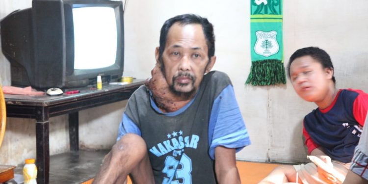 Lahmuddin Tambusai, Penderita Tumor di Leher Dirujuk ke Rumah Sakit Umum Siantar