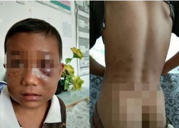 Sedihnya, Seorang Bocah Piatu Bermarga Panjaitan ini Terkapar Dianiaya Namboru