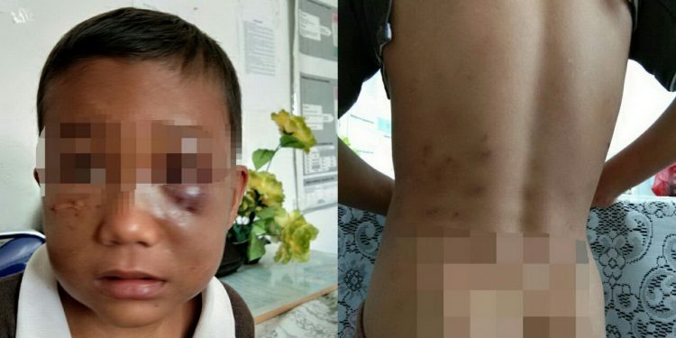 Sedihnya, Seorang Bocah Piatu Bermarga Panjaitan ini Terkapar Dianiaya Namboru