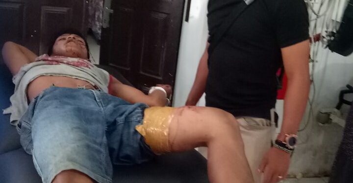 Melawan Saat Ditangkap, Perampok Sepedamotor ini Ditembak Polisi Melawan Saat Ditangkap, Perampok Sepedamotor ini Ditembak Polisi