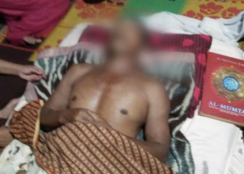 Dua Warga Disambar Petir Saat Bersihkan Kolam, Satu Tewas di TKP