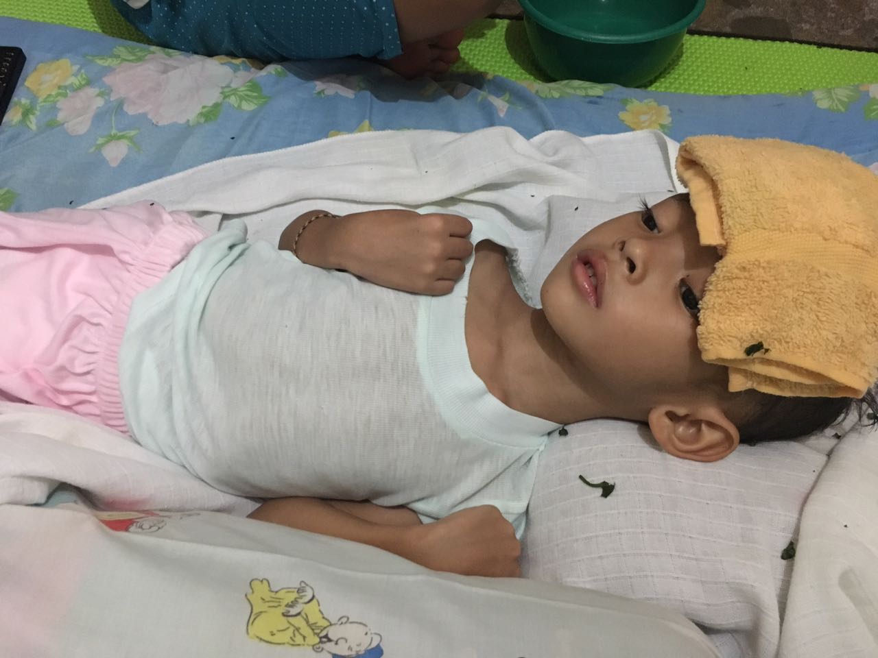 Kasihan, Alvaro yang Dulu Ceria dan Lincah, Kini Hanya Terbaring Kaku Akibat Penyakitnya...