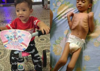 Kasihan, Alvaro yang Dulu Ceria dan Lincah, Kini Hanya Terbaring Kaku Akibat Penyakitnya...