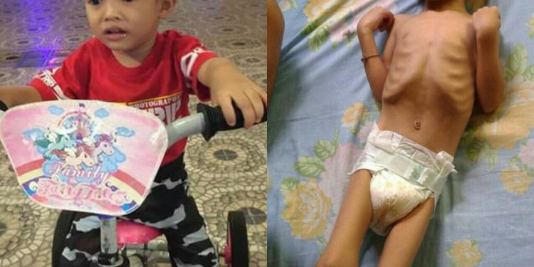 Kasihan, Alvaro yang Dulu Ceria dan Lincah, Kini Hanya Terbaring Kaku Akibat Penyakitnya...