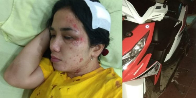 Masyonty Hutagaol, Guru Honor Dijambret Pelajar Saat Bonceng Rekannya di Jalin Perdagangan - Siantar Masyonty Hutagaol, Guru Honor Dijambret Pelajar Saat Bonceng Rekannya di Jalin Perdagangan - Siantar
