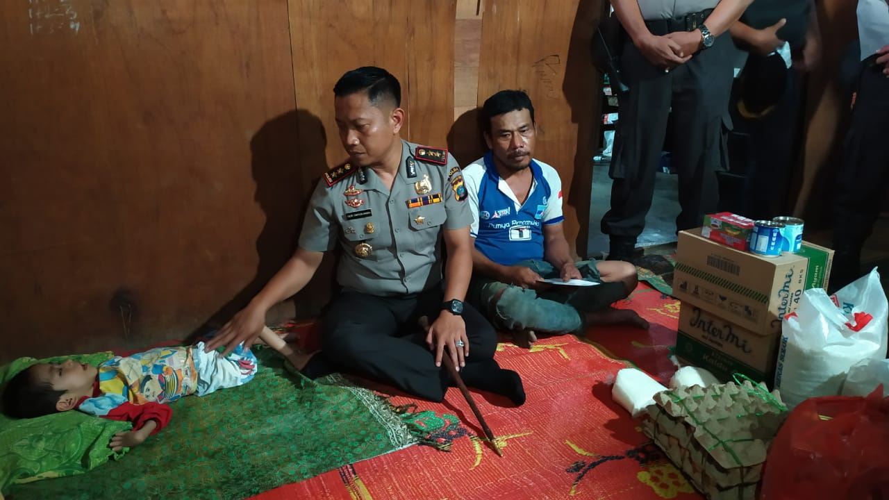 Juandi Sehat Purba, Bocah Lumpuh dari Keluarga Kurang Mampu di Simalungun Butuh Uluran Tangan