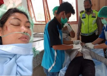Ditabrak Truk Fuso di Jalan Siantar-Parapat, Agustina Boru Rajagukguk Dilarikan ke RS, Simon Tanjung Tewas di TKP