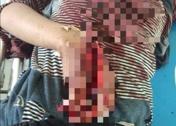Martua Siregar Bacok Putrinya yang Masih 12 Tahun, Diduga Menutup Aib
