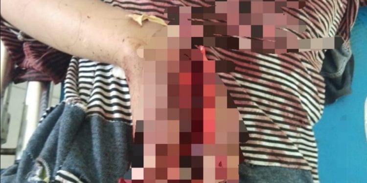 Martua Siregar Bacok Putrinya yang Masih 12 Tahun, Diduga Menutup Aib Martua Siregar Bacok Putrinya yang Masih 12 Tahun, Diduga Menutup Aib