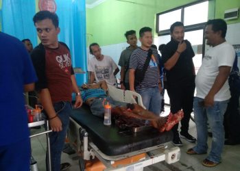 Kesal Diomeli, Jumasri Siramkan Minyak lalu Bakar Ibu Tirinya