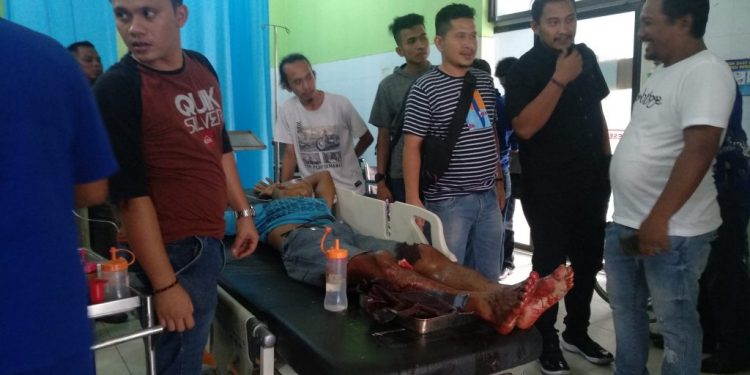 Kesal Diomeli, Jumasri Siramkan Minyak lalu Bakar Ibu Tirinya