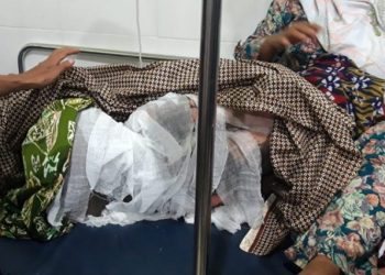Tak Beritahu Password HP, Seorang Suami Dibakar Istrinya