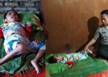 Juandi Sehat Purba, Bocah Lumpuh dari Keluarga Kurang Mampu di Simalungun Butuh Uluran Tangan