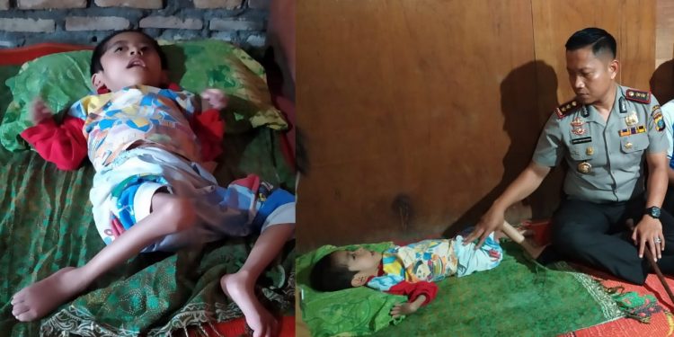 Juandi Sehat Purba, Bocah Lumpuh dari Keluarga Kurang Mampu di Simalungun Butuh Uluran Tangan