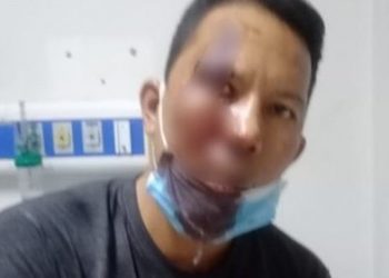 Barita Limbong, Driver Online Dianiaya Oknum Polisi yang Jadi Customernya