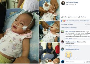 Jeritan Hati Bayi Tuna Netra yang Ditinggal Ibunya. Dituliskan Dokter Imelda Siregar dan Viral di Hari Ibu...