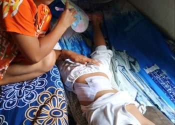Bocah 5 Tahun Diserang 2 Ekor Monyet Liar, Hingga Harus Dapat 42 Jahitan
