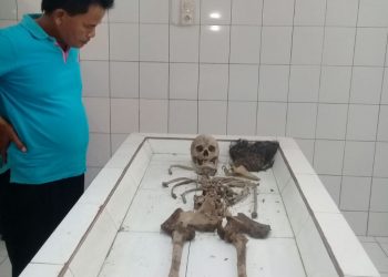 Tengkorak Manusia di Hutan Brombos, Wanita Berusia 50 Tahun