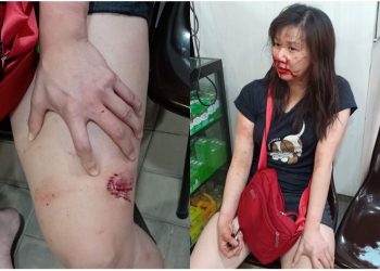 Paha Wanita Cantik Digigit Pria Berbadan Besar di Jalan Thamrin