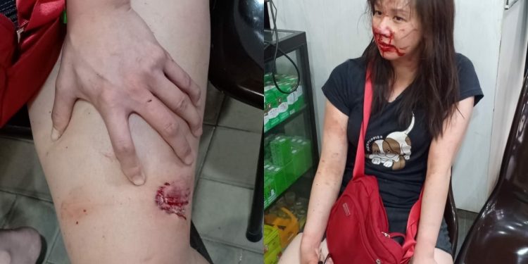 Paha Wanita Cantik Digigit Pria Berbadan Besar di Jalan Thamrin