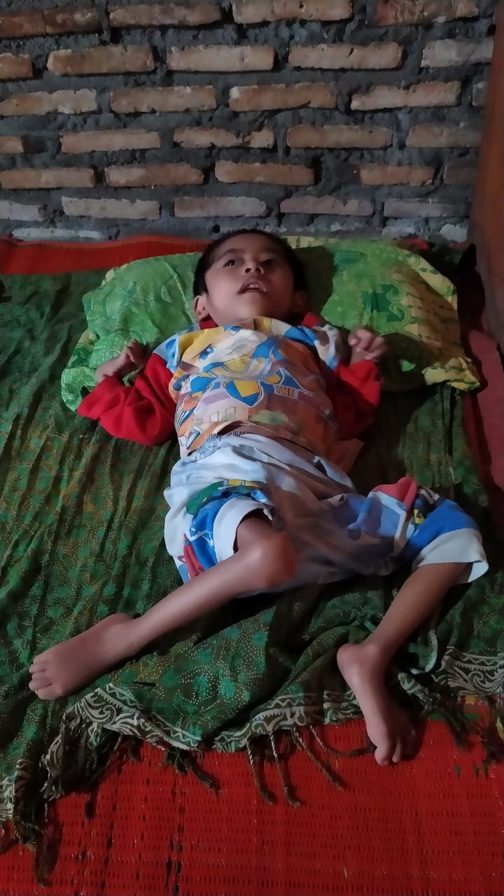 Juandi Sehat Purba, Bocah Lumpuh dari Keluarga Kurang Mampu di Simalungun Butuh Uluran Tangan