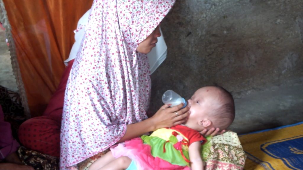 AKBP Horas Tua Silalahi Kunjungi Keluarga dan Anak Penderita Hydranencephaly