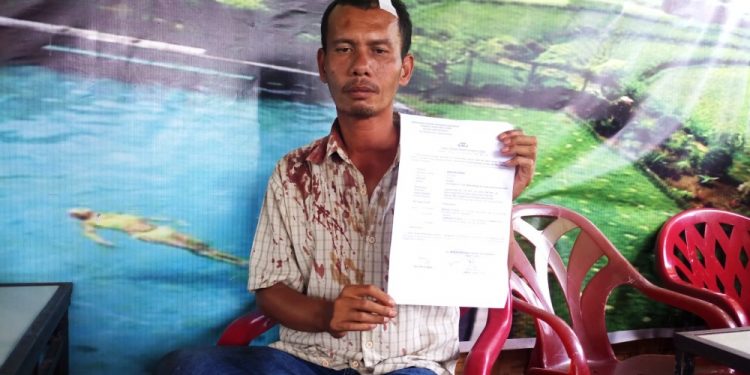 Rebutan Harta Warisan, Brexson Sitorus Bersimbah Darah Dibacok Abang Kandungnya Rebutan Harta Warisan, Brexson Sitorus Bersimbah Darah Dibacok Abang Kandungnya