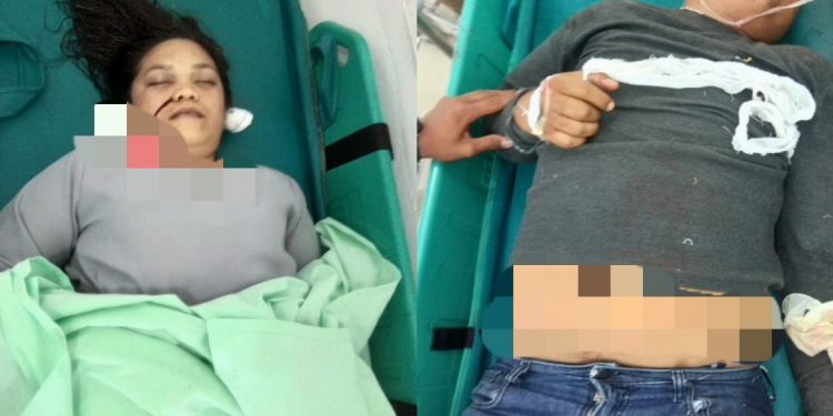 Sepedamotor Putra Hutabarat Kecelakaan di Sidikalang, Istrinya Meregang Nyawa