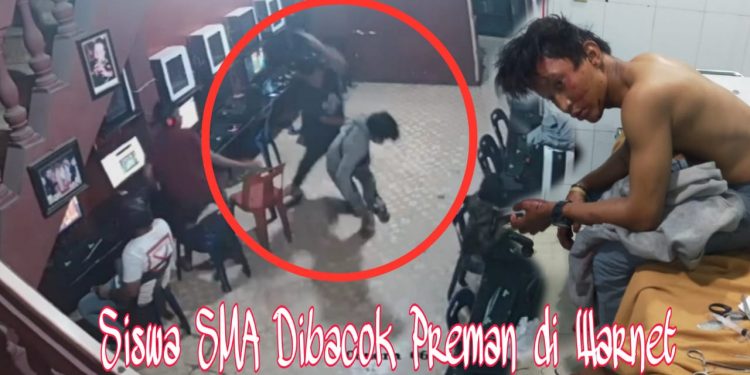 Usai Disuruh Beli Kopi Susu, Texas Silalahi Siswa SMA Free Methodist ini Dibacok Preman